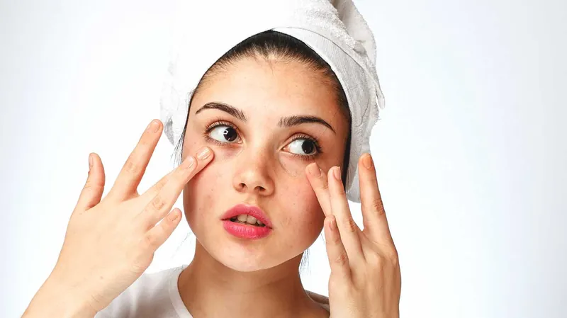 dry skin