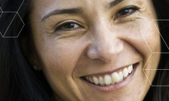 Skincare 101: Pigmentation – What Is It and How Can You Treat It? pigmentation