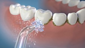 Waterpik Cordless Plus Water Flosser