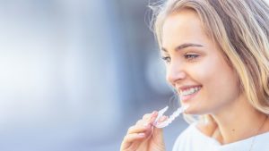 active aligners
